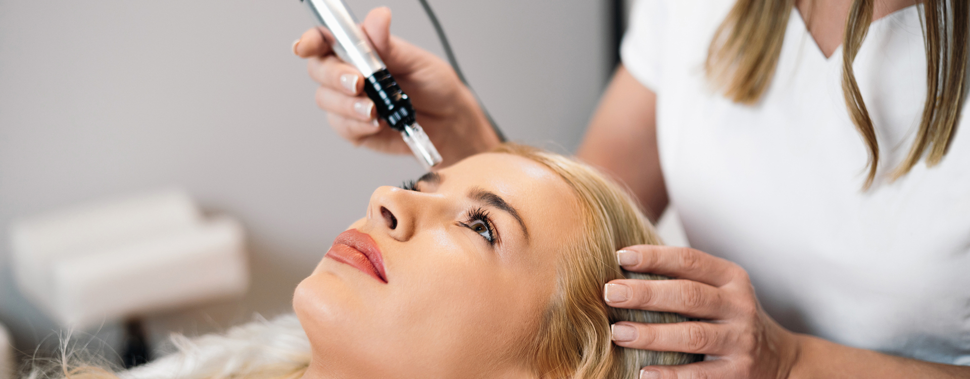 Microneedling